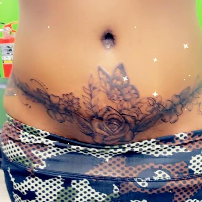 Best Tummy Tuck CoverUp Tattoo  Studio Conceal