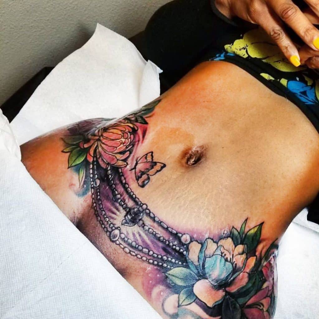 Tattoos to cover up a Tummy Tuck Scar why not try a Nude Tattoo Scar   Stretch Mark Camouflage Medical Tattoos