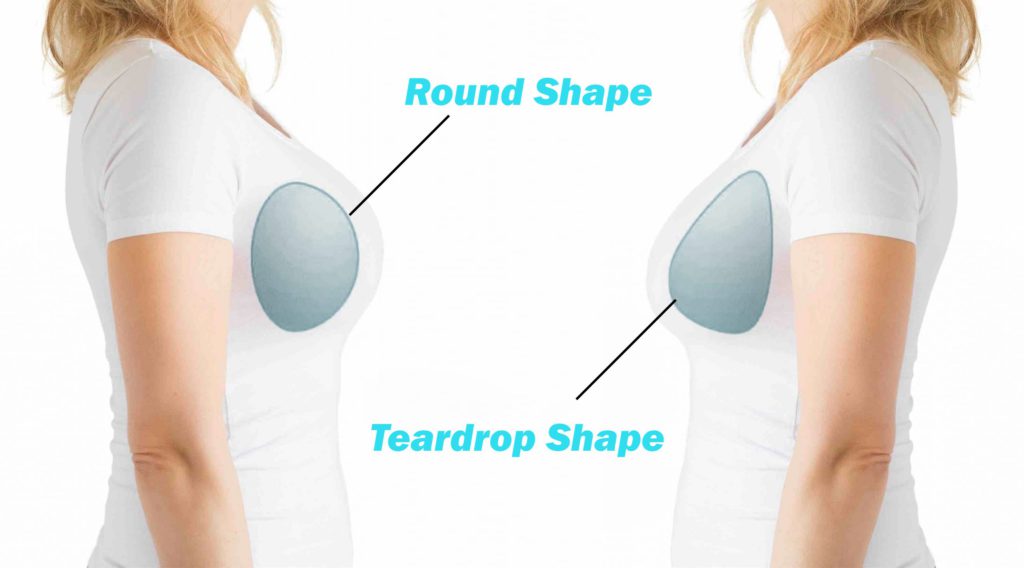 What Are Teardrop Breasts?
