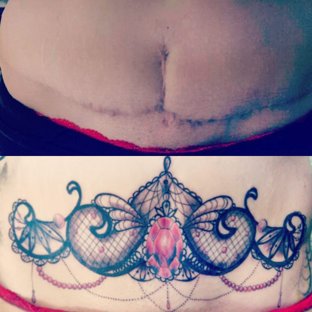 Mommy Makeover See What This Tummy Tuck Cover Up Tattoo Does  YouTube
