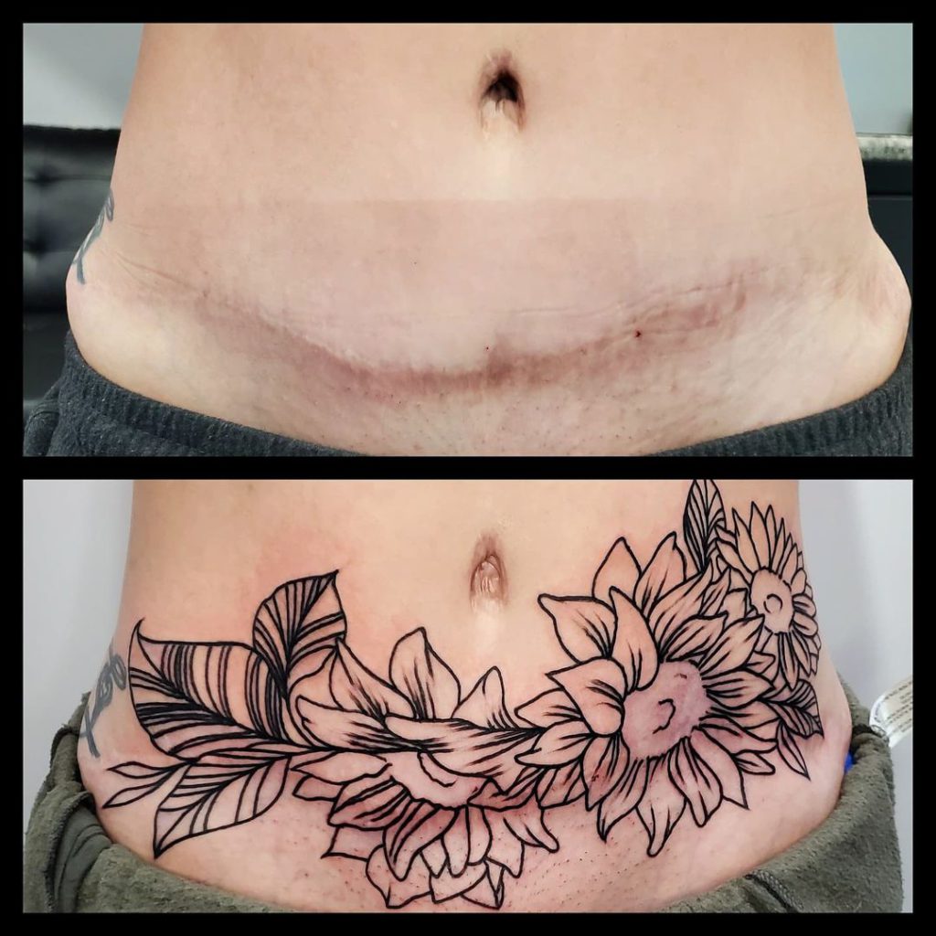 I got a makeover after five Csections gave me jelly belly  tummy tuck  boob job and lipo are the best things Ive done  The Sun
