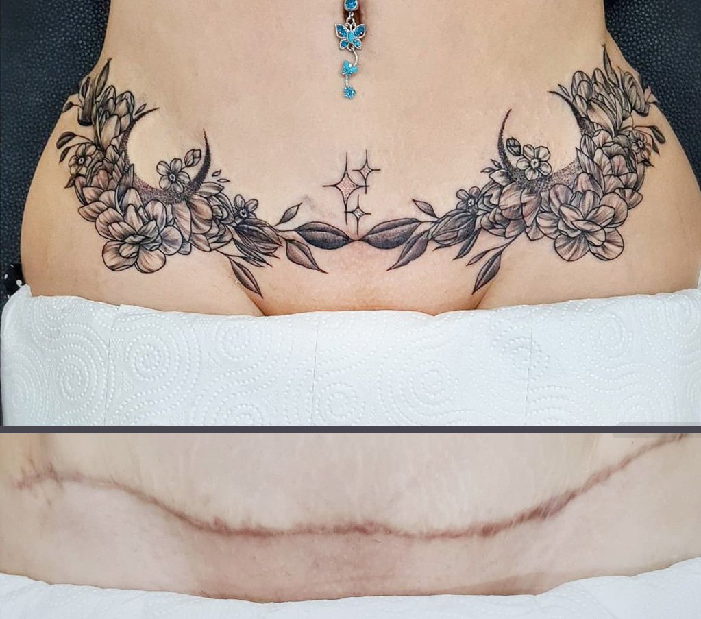 A tummy tuck scar/ dragon fly cover up... - Ink & Iron tattoo | Facebook