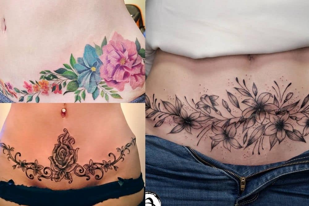 TuckTats Blossom Floral Temporary Tattoo  Tummy Tuck Scar Cover  Realistic and Long Lasting Fashionable and Safe  Amazonca Beauty   Personal Care