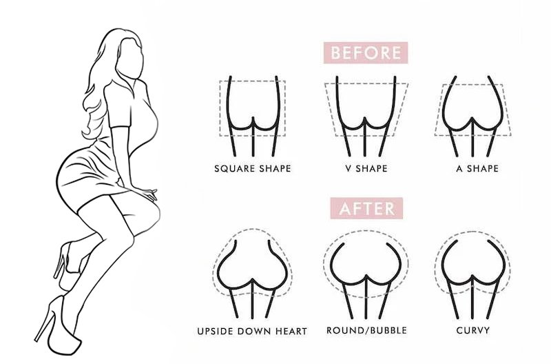 BBL Without Surgery - A Guide for Plus-Size Bodyshapes 