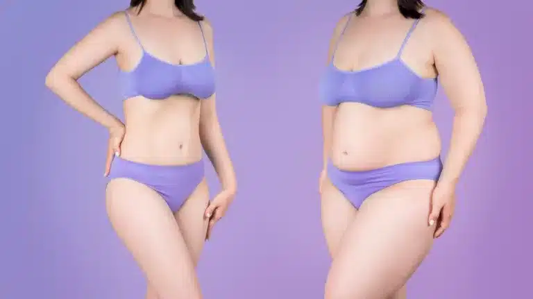 Plus Size Lipo 360 and BBL: The Ultimate Solution