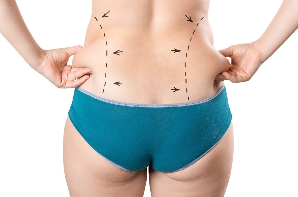 Women's BBL Faja Tummy Control Body Shaper High Compression Post Surge