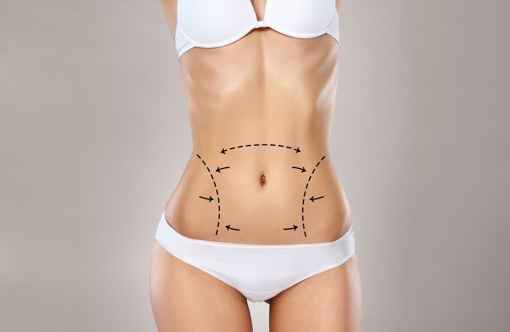 Plus Size Lipo 360 and BBL: The Ultimate Solution